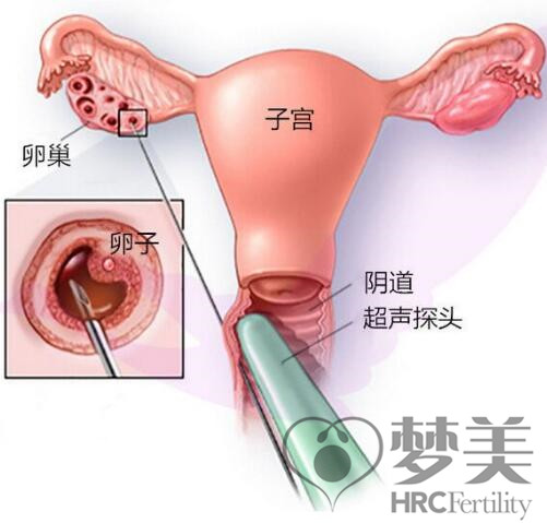 QQ截图20171031105613.jpg